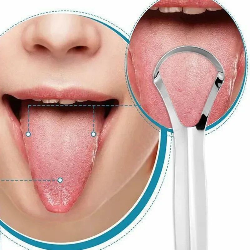 Grattoir de langue propre dissolvant de langue halitose revêtement de langue soins bucco-dentaires brosse à gratter de langue outils de nettoyage buccal en acier inoxydable