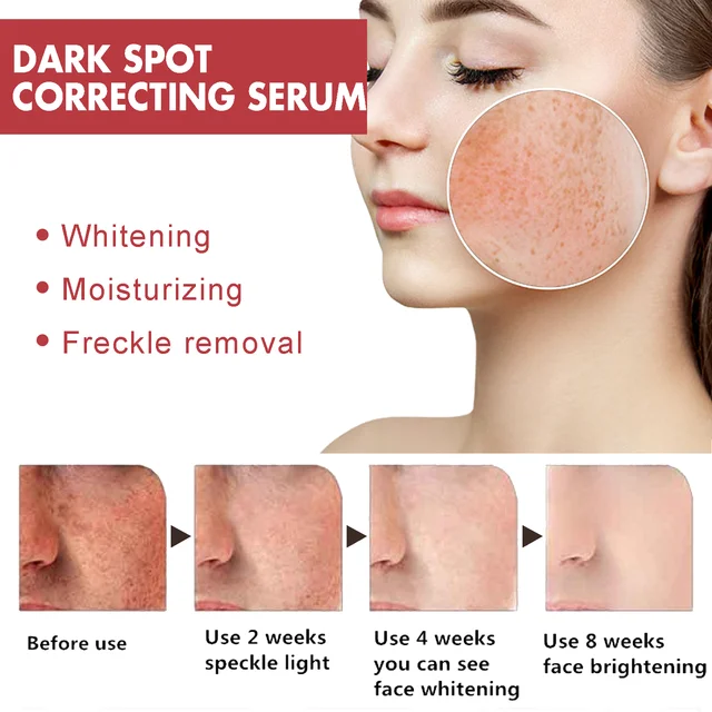 Niacinamide-Sérum anti-taches foncées pour le visage, correction de taches de rousseur, hydratant, éclaircissant, anti-pigmentation, réparation de la peau, soins de la mélanine – Image 4