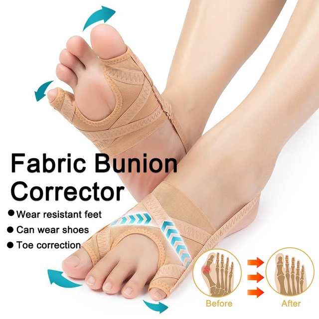 Correcteur d'oignon en tissu respirant et réglable, séparateur d'espacement de manches d'hallux Valgus, correcteur d'orteils, chaussettes de sport pour course à pied