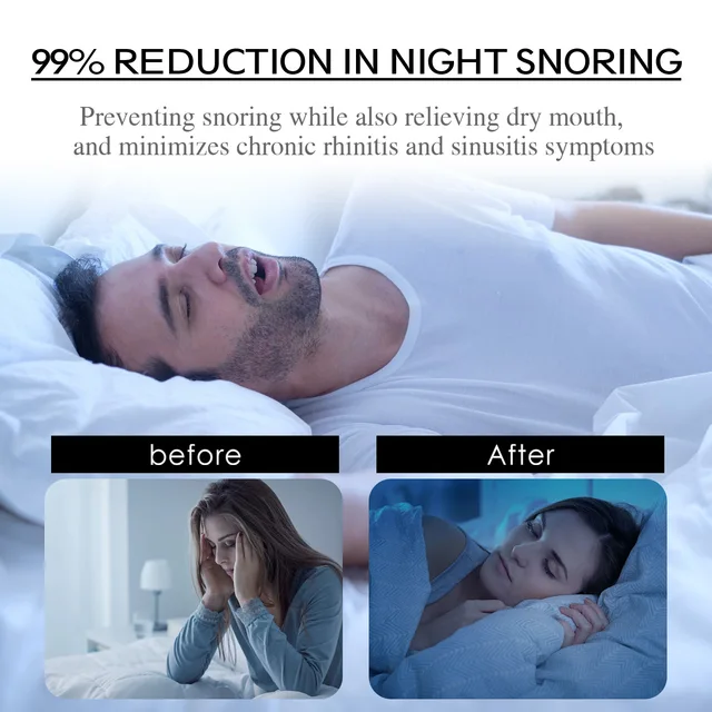 Autocollant anti-sicing pour adulte, favorise un meilleur sommeil, améliore la ories buccale, SAP, ronflement, nuit, ration, bande buccale – Image 3