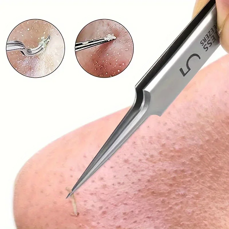 1 paquet extra fin n° 5 pincettes cellulaires pour points noirs d'acné, outils de beauté du visage pour éliminer l'acné, pour les soins de la peau