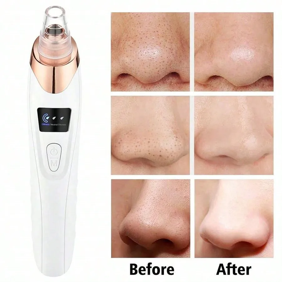 Nettoyant électrique pour les soins de la peau du visage, élimine l'acné sous vide, les pores profonds du visage, dissolvant de points noirs pour femmes