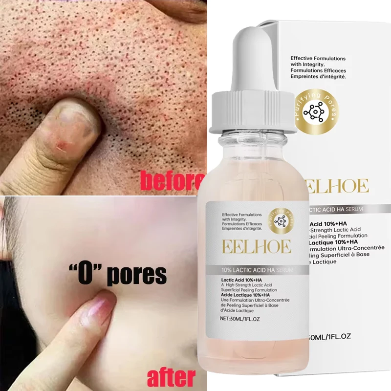 Sérum pour le visage à l'acide lactique, rétrécit les Pores, élimine les points noirs, contrôle de l'huile, Essence de réparation, lisse, raffermissant, soins pour la peau