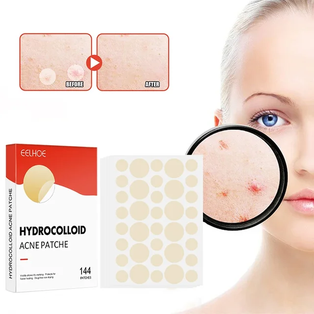 144 pièces/ensemble visage soins de la peau acné bouton Patch 2 tailles Invisible professionnel guérison absorbant tache autocollant couvrant pour hommes femmes – Image 2