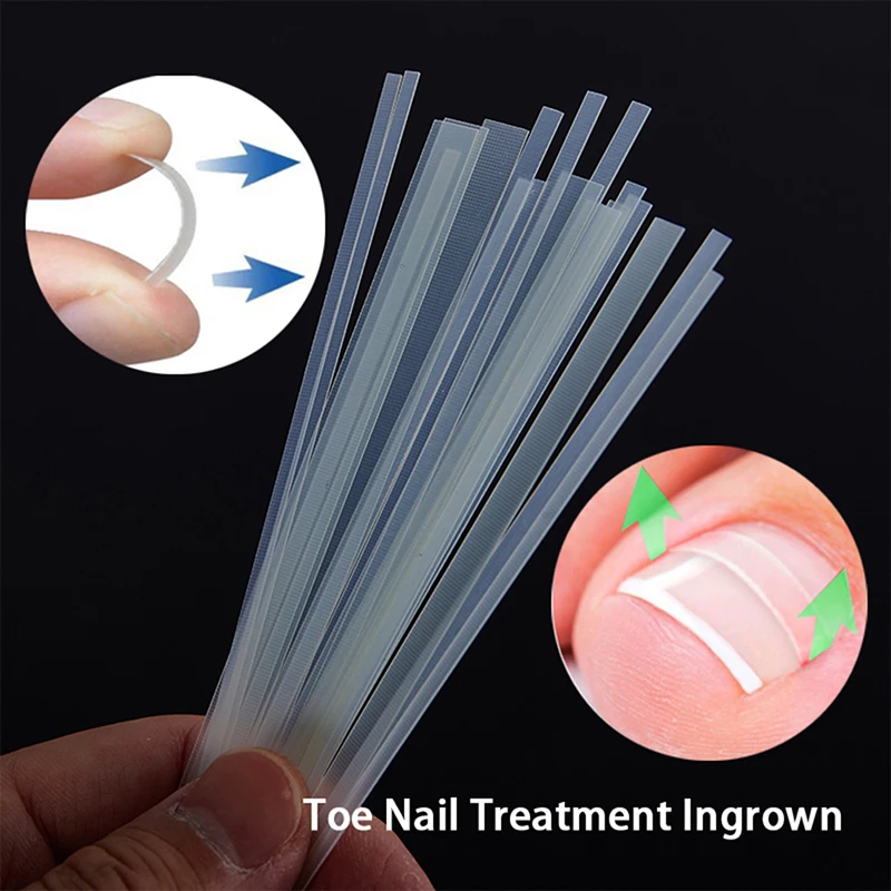 Correcteur d'ongles incarnés, Patch élastique pour l'orteil intérieur des orteils, autocollant, support de Clip, thérapie des pieds, Paronycbia, pédicure, outil de soins des ongles, 5 pièces