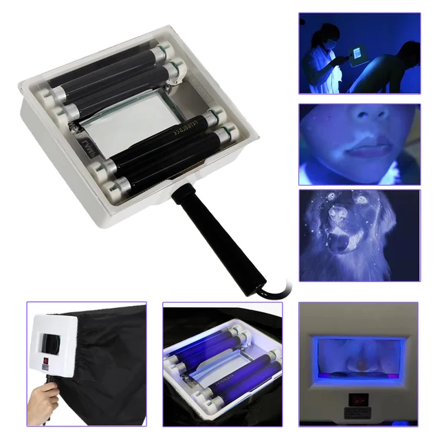AOKO bois UV lampe analyseur d'évaluation de la peau peau du visage vitiligo test examen loupe Machine greidité peau Tinea – Image 6