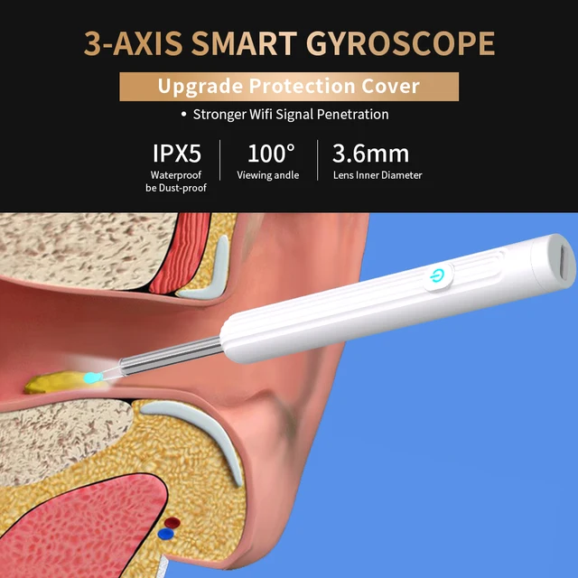 Nettoyeur d'oreille visuel intelligent avec caméra 1296P, bâtons d'oreille, chargement USB C, outil de suppression d'avertissement d'oreille, connexion WiFi, 6 lumières LED, cure-oreille – Image 2