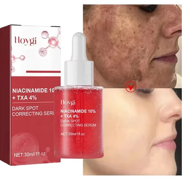 Niacinamide-Sérum anti-taches foncées pour le visage, correction de taches de rousseur, hydratant, éclaircissant, anti-pigmentation, réparation de la peau, soins de la mélanine