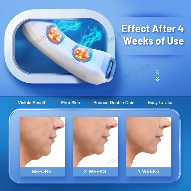 Ohio eur facial à double vibration pour le ruisseau, appareil de beauté, lifting du visage, ceinture de mise en forme, V-Line Up, Ems Facial Lifter – Image 2